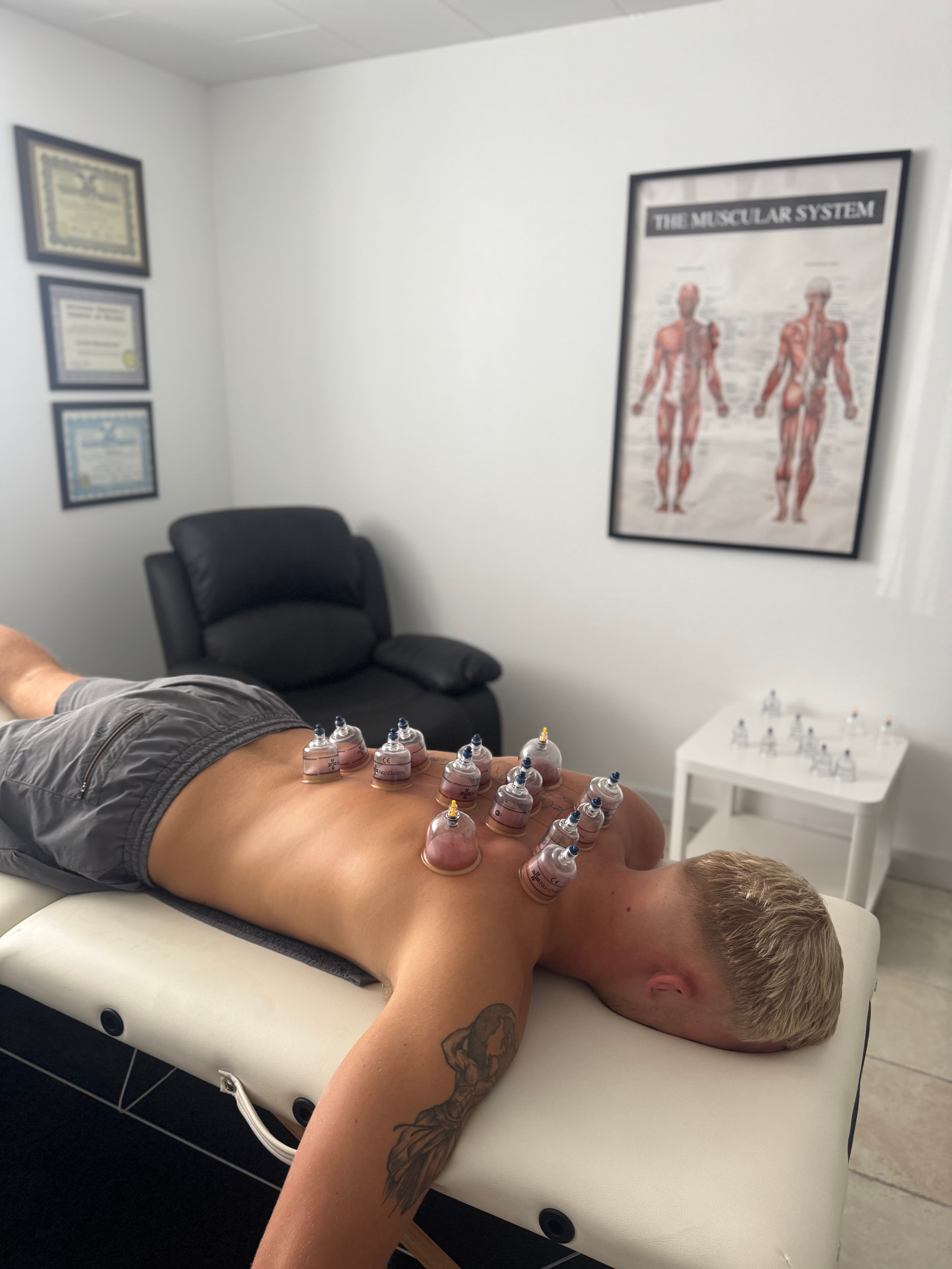 Cupping Behandling